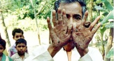 Arsenic Creates Social Crisis in Bangladesh